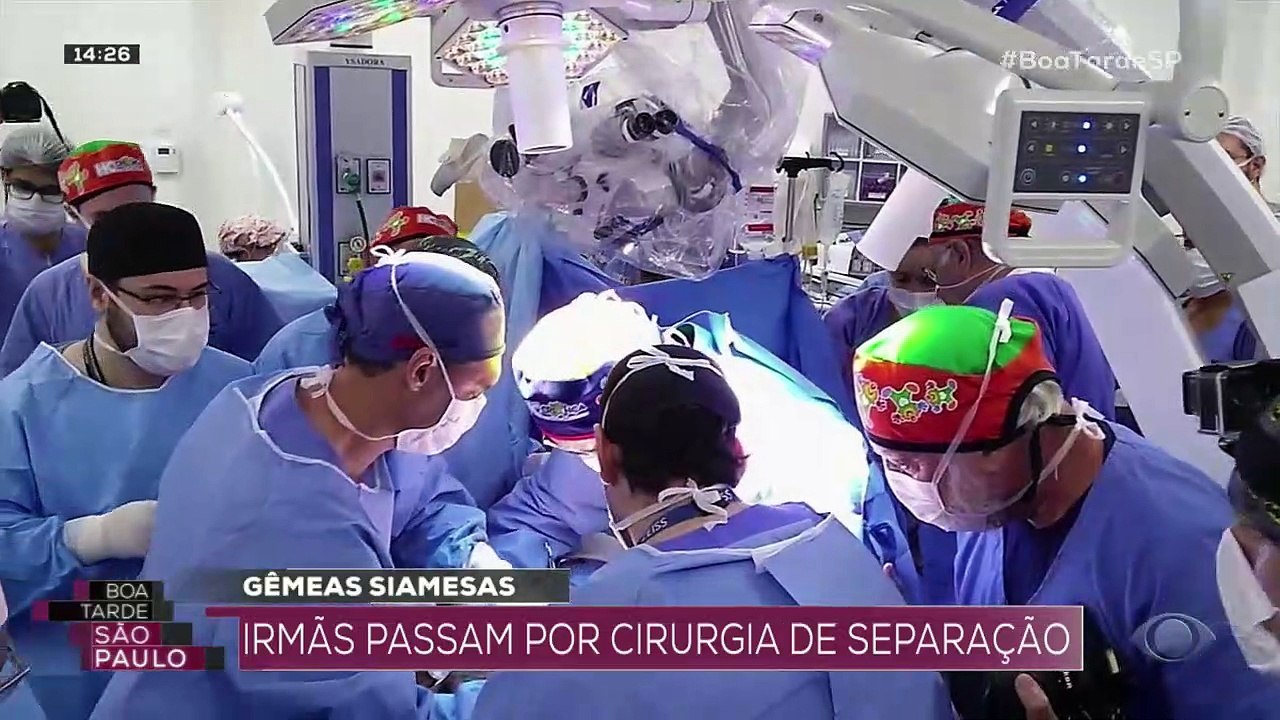 Gêmeas siamesas: irmãs passam por cirurgia de s...