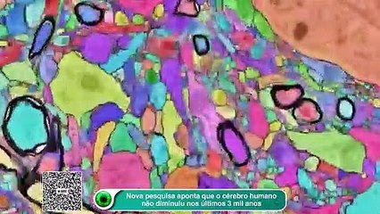 Cérebro humano diminuiu? Estudo traz uma nova resposta sobre isso