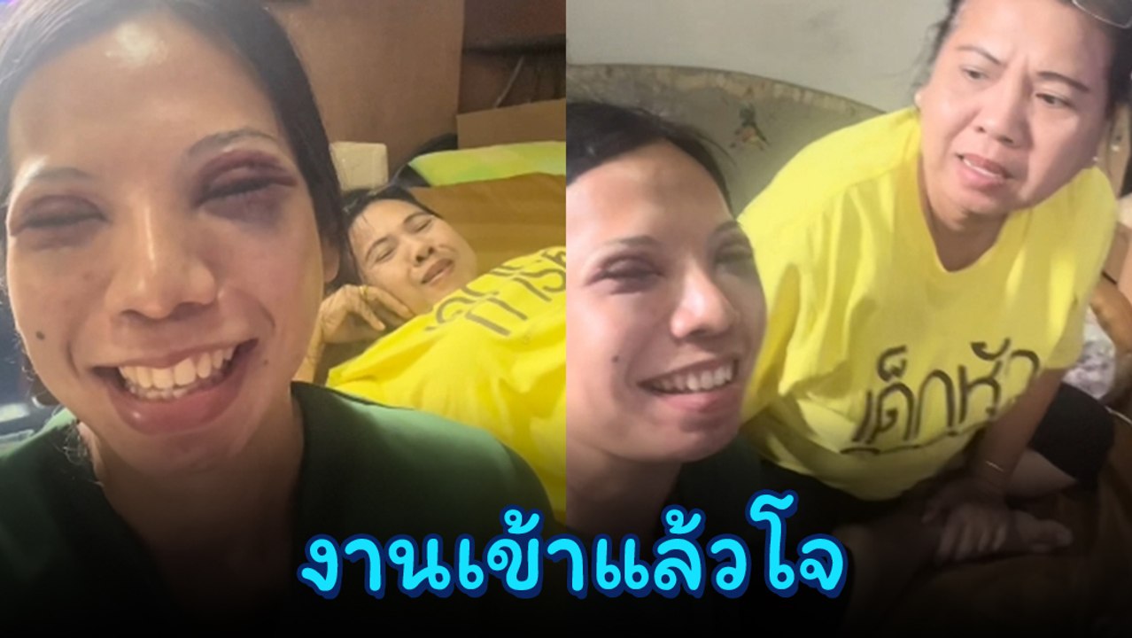 โจหนีไป ! ลูกสาวไปทำตา 2 ชั้น แวบแรกแม่คิดว่าฟิ...