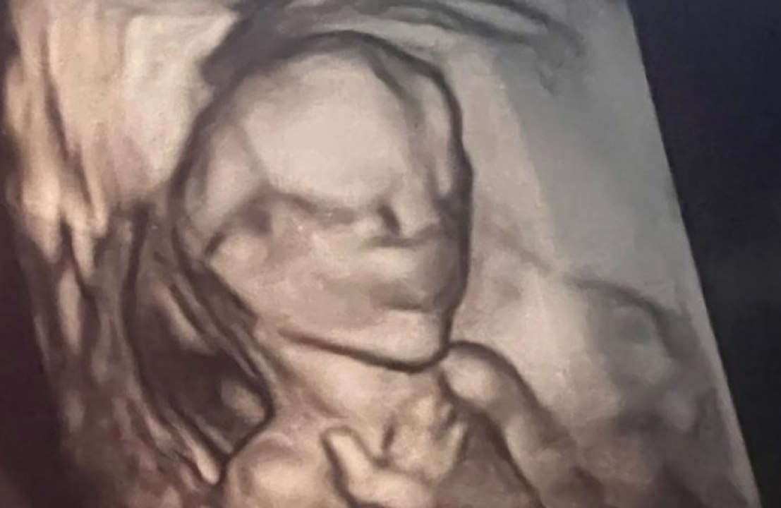 Chrissy Teigen shares the first sonogram of her unborn baby to poke fun at Donald Trump