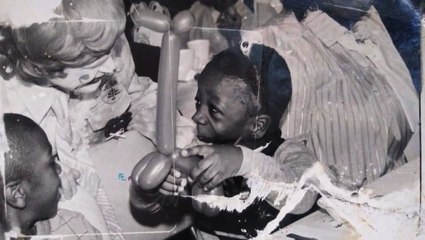 I Have No Jaw - But Still Found True Love | LOVE DON'T JUDGE