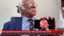 84 yaşındaki hastanın burnundan 100 gramlık kitle alındı
