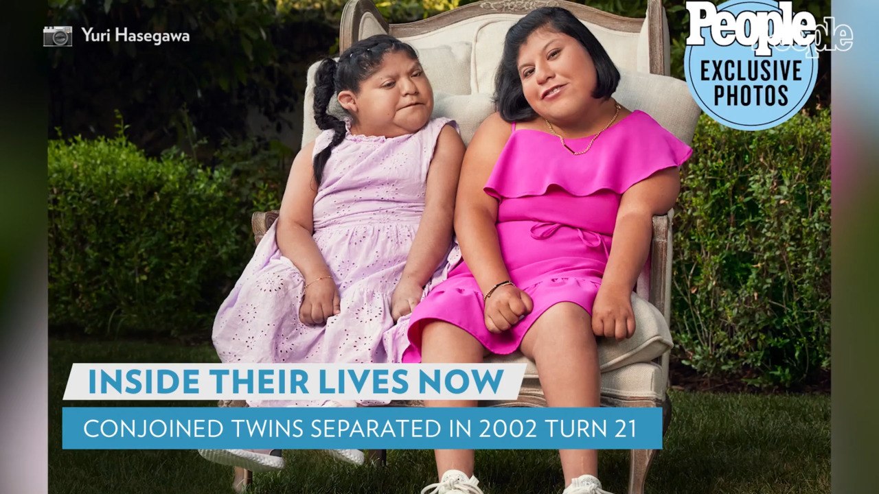 Conjoined Twins Who Made Headlines for 2002 Separation Surgery Turn 21: Inside Their Lives Now
