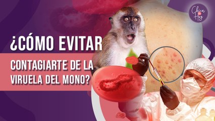 ¿Cómo evitar contagiarte de la viruela del mono?
