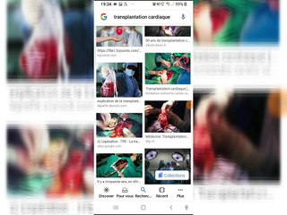 564 HISTOIRE FEMME FATIGUEE VERTIGES NAUSEES HYPERTENSION