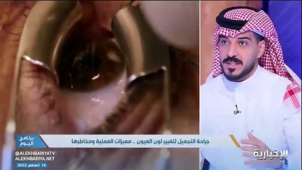 استشاري يحذر من جراحة تغيير لون عدسة العين.. ويؤكد: غير قانونية بالمملكة