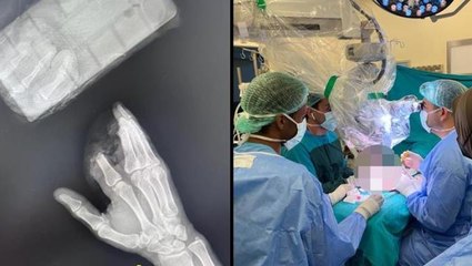 Elini makineye kaptıran adam, kopan 3 parmağını poşete koyup hastaneye koştu