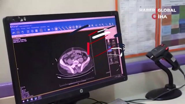 Ölümden döndü! Karın ağrısı şikayetiyle gittiği hastanede gerçeği öğrendi +