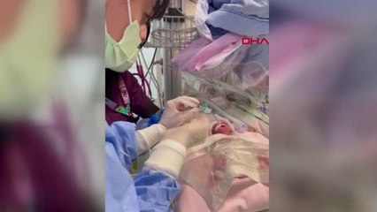 540 GRAMLIK PARMAK BEBEK RABİA'YI KÖK HÜCRE TEDAVİSİ HAYATA BAĞLADI