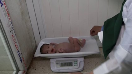 "سوِء التغذية" ينهش أجساد أطفال أفغانستان