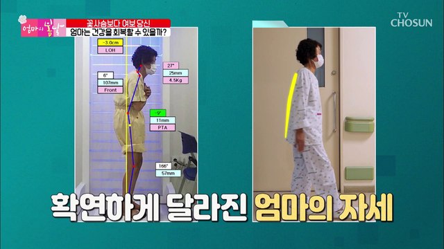 엄마의 허리 건강 상태가 수술 후 확연하게 달라진 모습 TV CHOSUN 20220813 방송
