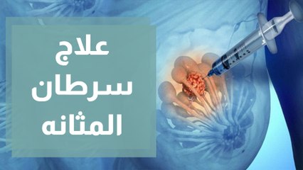 ما هي ابرز طرق علاج سرطان المثانة؟
