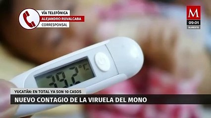 Yucatán reporta nuevo contagio de la viruela del mono