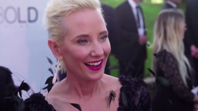 '뇌사 판정' 美 배우 앤 헤이시, 장기기증 후 영면 / YTN