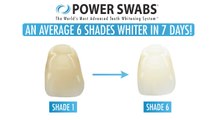 Brighten your smile and look younger with Power Swabs