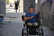 Adana haberleri! Adanalı 8 yaşındaki Muhammed protez bacakla yürüyecek