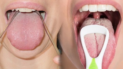 Tongue Clean करने के लिए  Steel Ya Plastic कौन सा Tongue Cleaner Best । Boldsky* Health