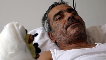 Elini giyotin makasına kaptırdı, kopan parmaklarını poşetle hastaneye götürdü