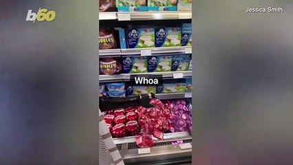 Bionic Hand Gives Paralympic Swimmer New Lease on Life