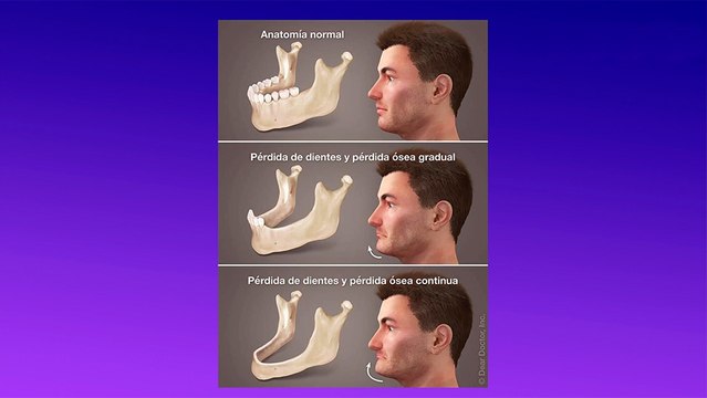 bd-hablamos-de-dientes-flojos-causas-y-tratamientos-160822