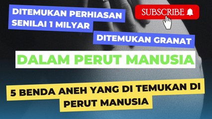 5 Benda Aneh Dalam Perut Manusia | Ada Perhiasan Senilai 1 Milyar Dan Granat