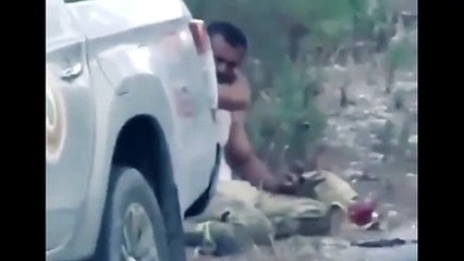 Yangına müdahale ederken yaralandı! Kolunu sarıp devam etti