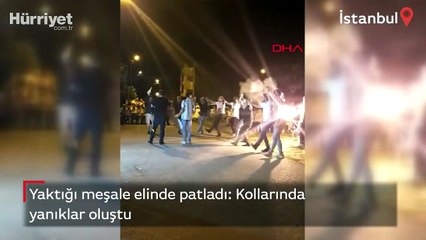 Yaktığı meşale elinde patladı