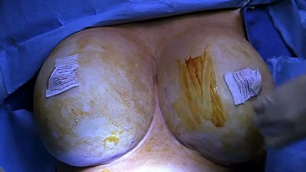 Nip-Tuck - Schönheit hat ihren Preis Staffel 1 Folge 12 HD Deutsch