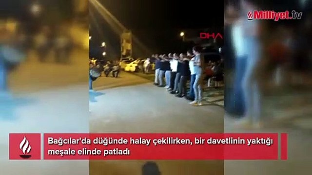 Düğünde yaktığı meşale elinde patladı