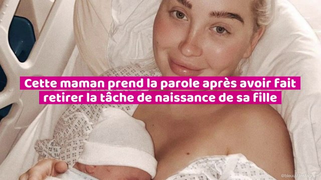 Cette maman prend la parole après avoir fait retiré la tache de naissance de sa fille