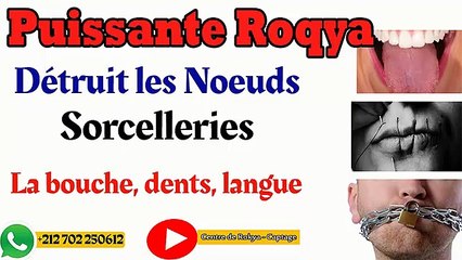 Roqya puissante Détruit Noeuds de sorcellerie dans la bouche, dents, langue #roqya #djinns amoureux, #coran #islam