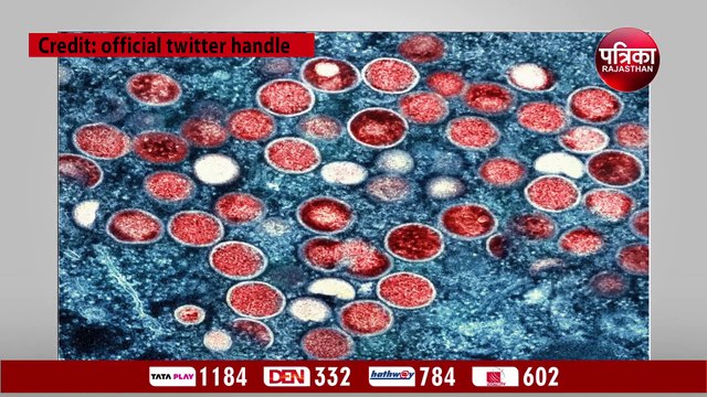 Monkeypox: मेडिकल जर्नल द लैंसेट में Monkeypox को लेकर हैरान कर देने वाला खुलासा