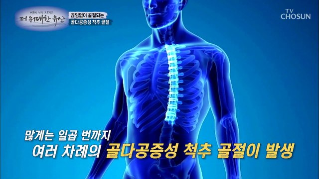 심혈관 질환을 발생시켜 사망까지 불러오는 골다공증 TV CHOSUN 20220818 방송
