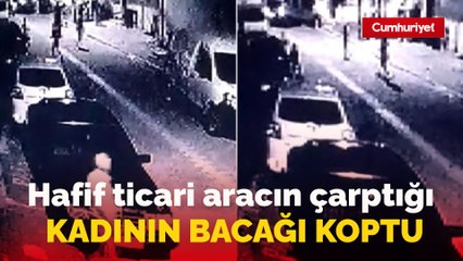 Esenyurt'ta hafif ticari aracın çarptığı kadının bacağı koptu