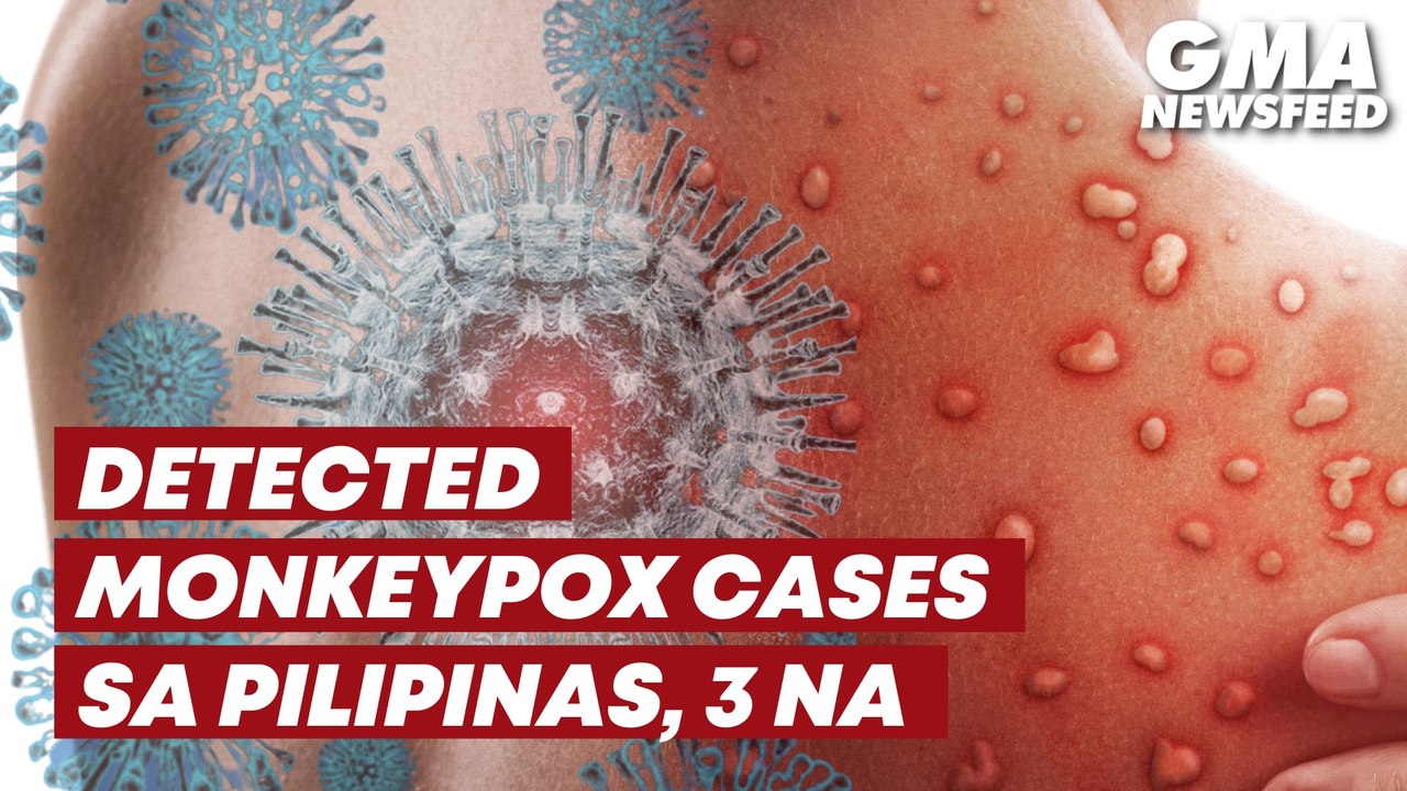 Philippines detects 2 more Monkeypox cases; total now 3 | GMA News Feed