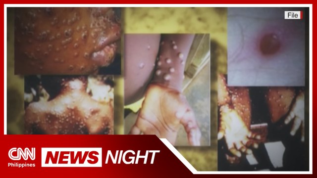 DOH reports two new Monkeypox cases | News Night