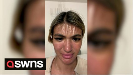 Beautician who fell asleep in the sun for 30 minutes was horrified when her skin was left looking plastic