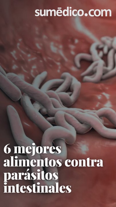 6 mejores alimentos contra parásitos intestinales