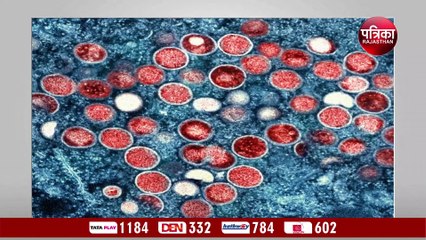 मंकीपॉक्स से एचआईवी का खतरा ! ICMR ने बताया सच