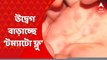 Tomato Flu: ভয় ধরাচ্ছে সোয়াইন ফ্লু এবং ‘টম্যাটো ফ্লু। উপসর্গ দেখা দিলে অবহেলা না করার পরামর্শ দিচ্ছেন চিকিৎসকরা। Bangla News