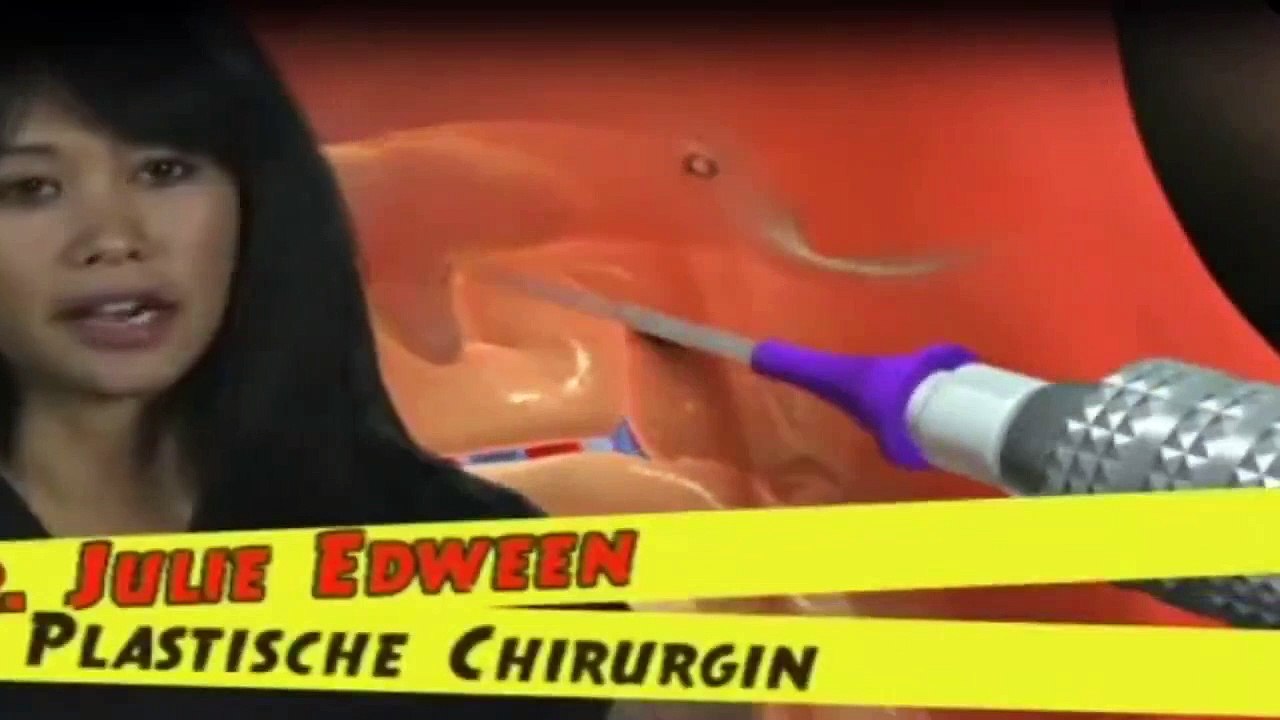 1000 Wege, ins Gras zu beißen Staffel 3 Folge 2 HD Deutsch