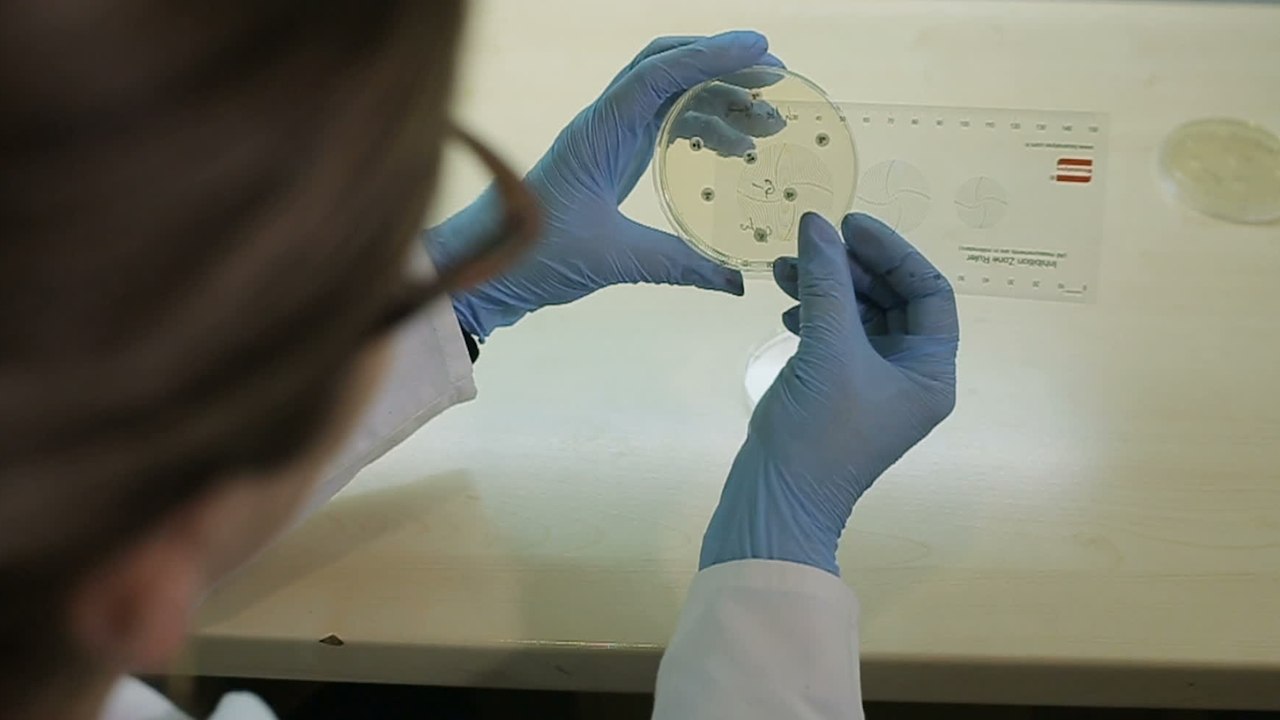 E.Coli outbreak in the U.S. leads some experts to advise against Wendy’s products with romaine lettuce