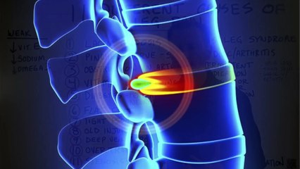 The 11 Causes of Leg Pain Revealed- Dr Burg