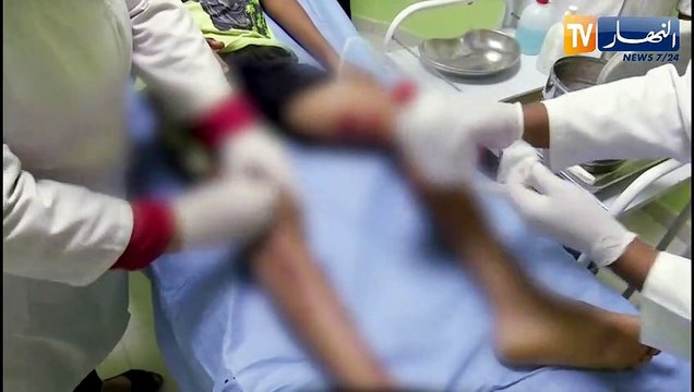 ورقلة: إنتشار الكلاب الضالة.. خطر يهدد الأطفال