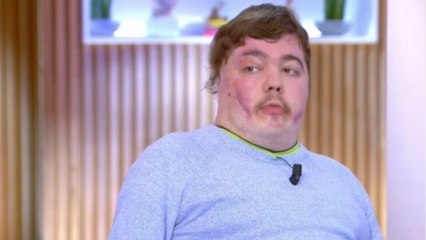 GALA VIDEO - Jonathan Destin : mort à 27 ans du symbole de la lutte contre le harcèlement scolaire