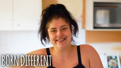 How I Cope With Tourette's Syndrome | BORN DIFFERENT