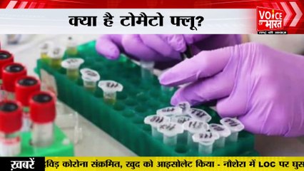 Tomato Flu : तेजी से फैल रहा है टोमैटो फ्लू, जानें क्या हैं लक्षण?