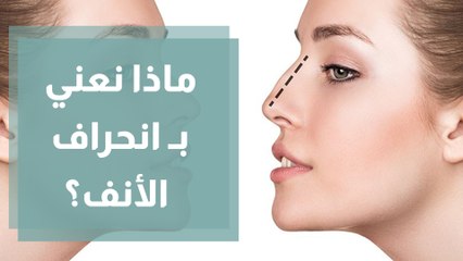 هل يمكن علاج انحراف وتيرة الأنف بدون جراحة؟