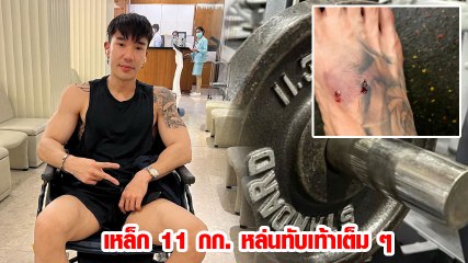 บอส ณัชพงศ์พล เตือนคนออกกำลังกาย หลังถูกเหล็ก 11 กก. ทับเท้า ลั่นปีนี้มีแต่เรื่องซวย