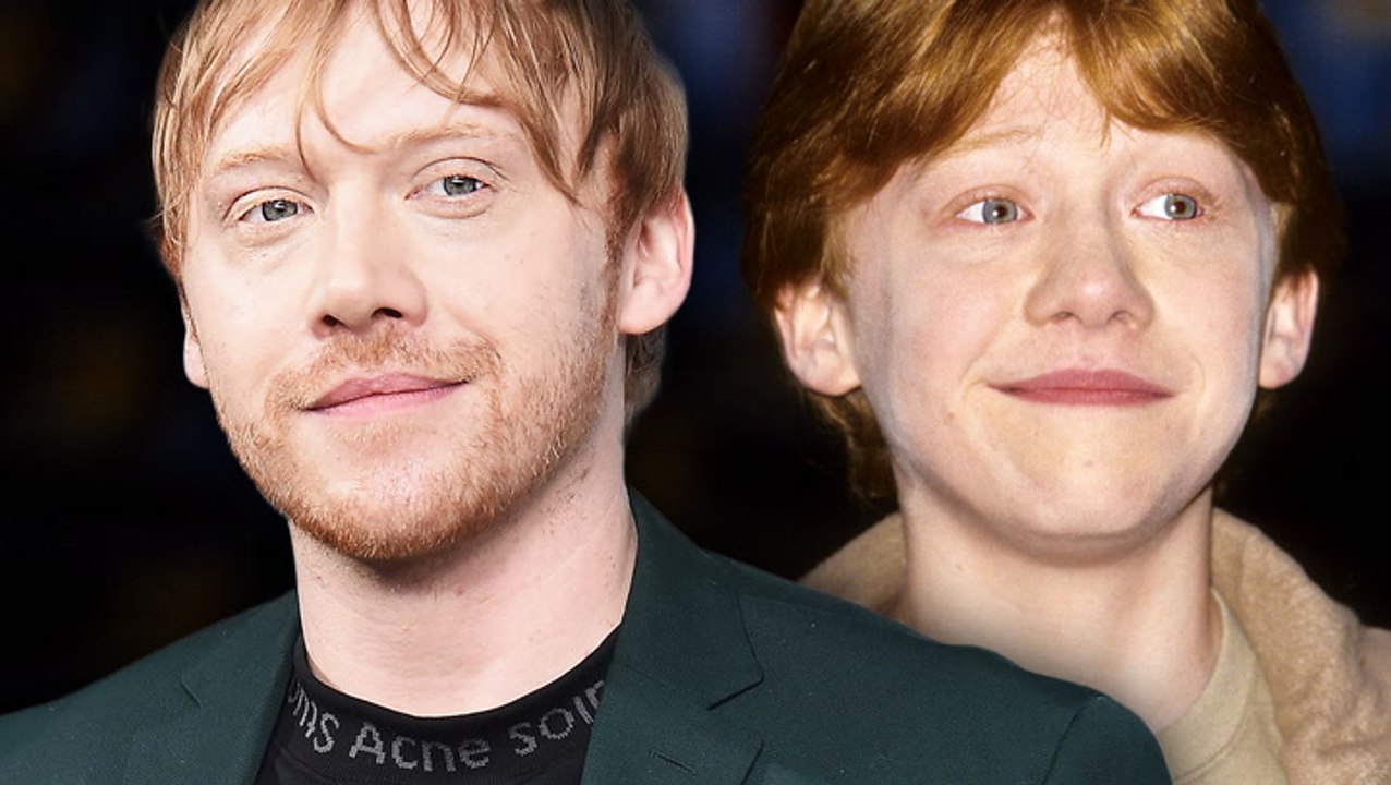 Die krasse Verwandlung von „Harry Potter“-Star Rupert Grint